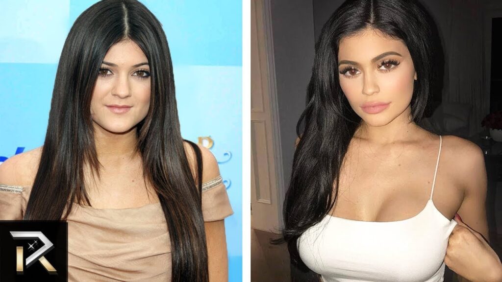 Shocking Celebrity Transformations You Won’t Believe!